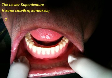 Επανορθωτικη οδοντιατρική